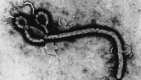 エボラウイルス 高温 消毒に弱い特徴も Scienceportal China